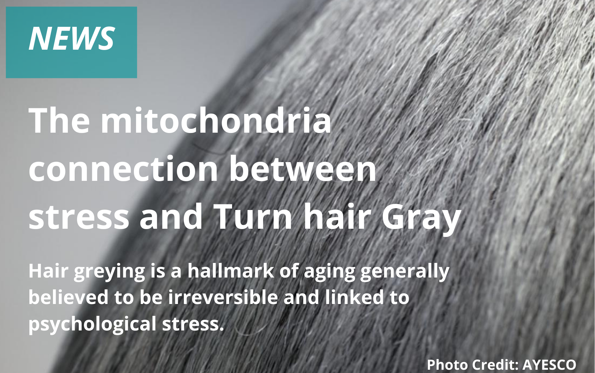 It's True: Stress Does Turn Hair Gray (And It's Reversible) - World  Mitochondria Society