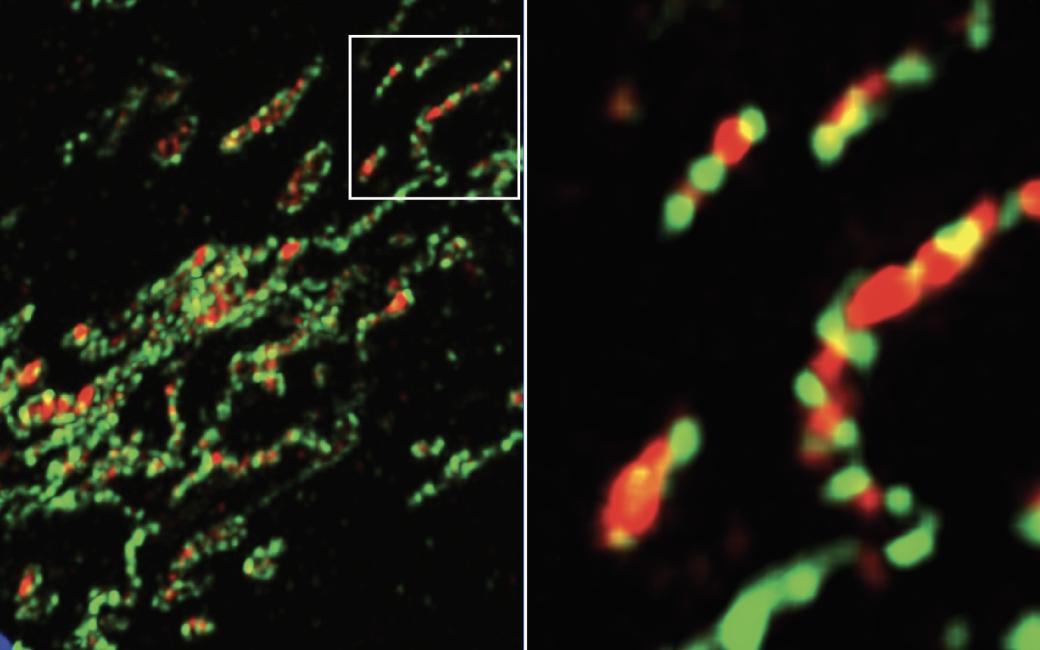 Balancing lipids and recycling to prevent mitochondrial meltdown