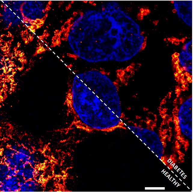 Licia Anna Pugliese Best Mitochondria Image