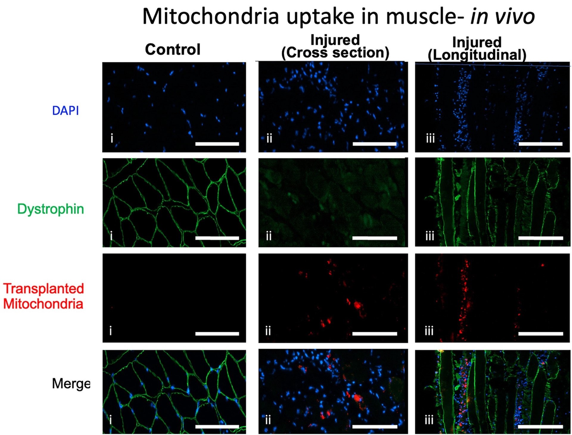 Mitochondria Transplant Therapy for Injured Skeletal Muscle