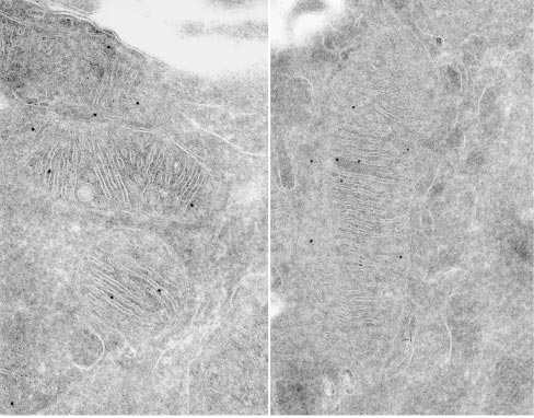 Submitochondrial-localization-of-Mgm1-OPA1-protein-as-determined-by-immuno-electron