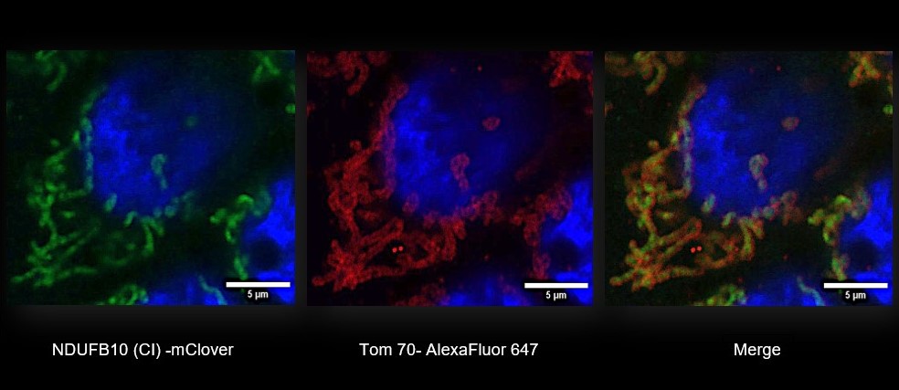 TASNIM ARROUM - Best mitochondria image 2