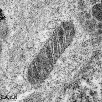TONI MARTINEZ-BERNABE Best Mitochondria Image
