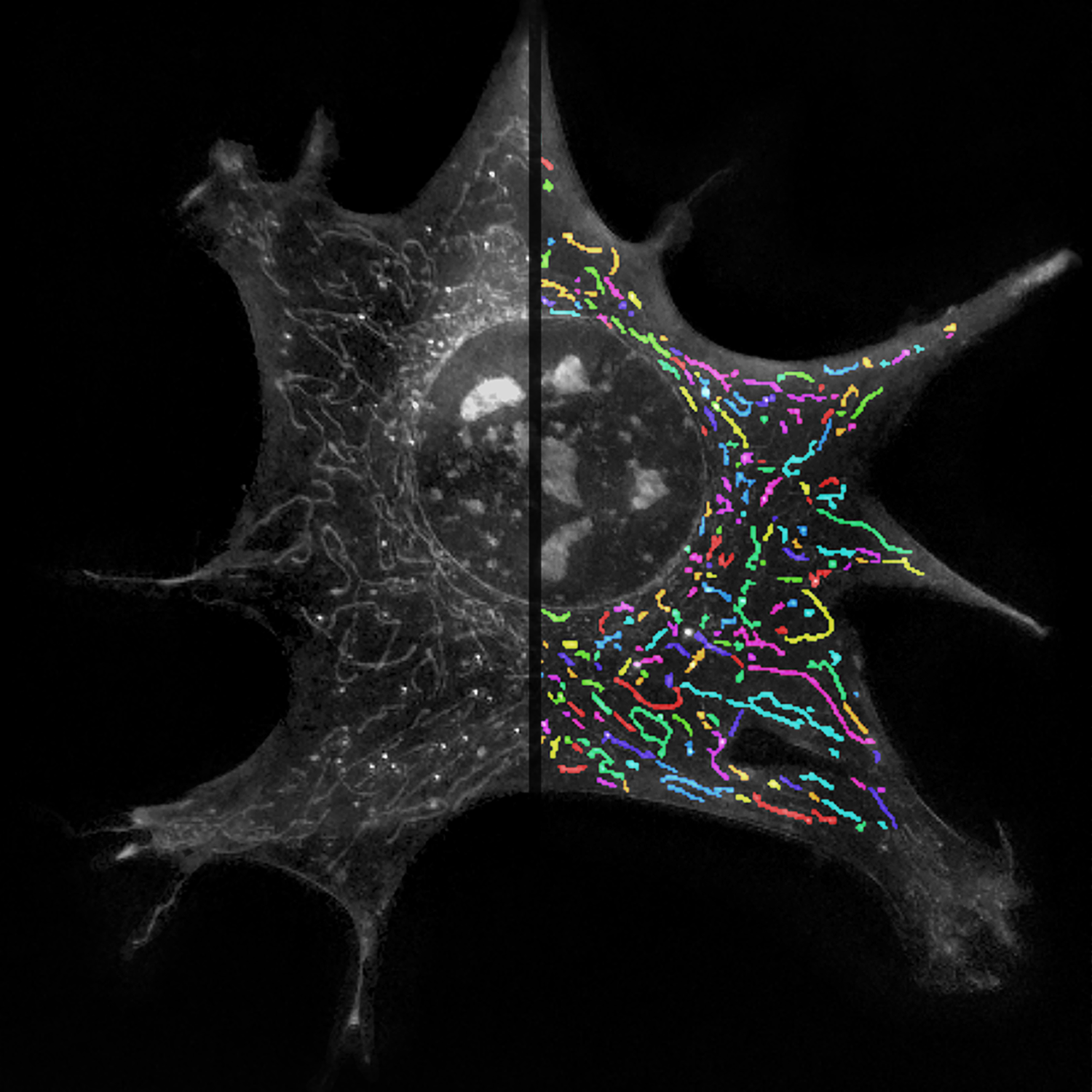 20. HugoMoreno - Living Networks - Preserving Mitochondrial Health with Label-free Holotomographic Vision