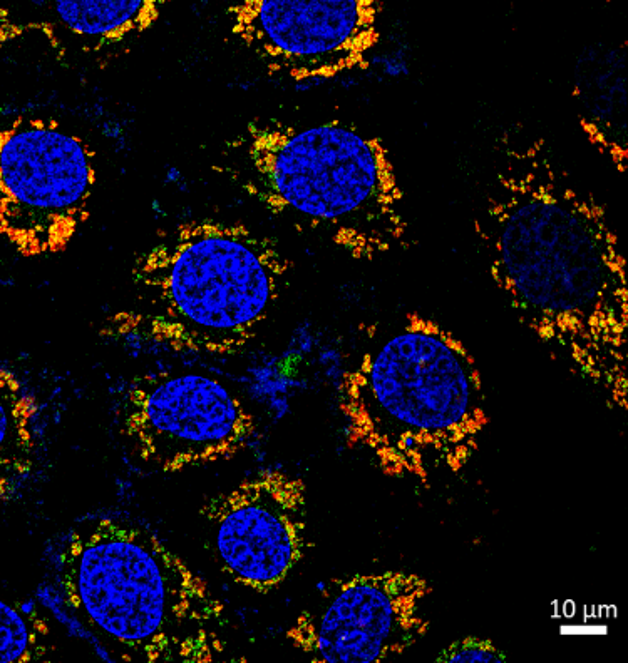 16. Mitochondria