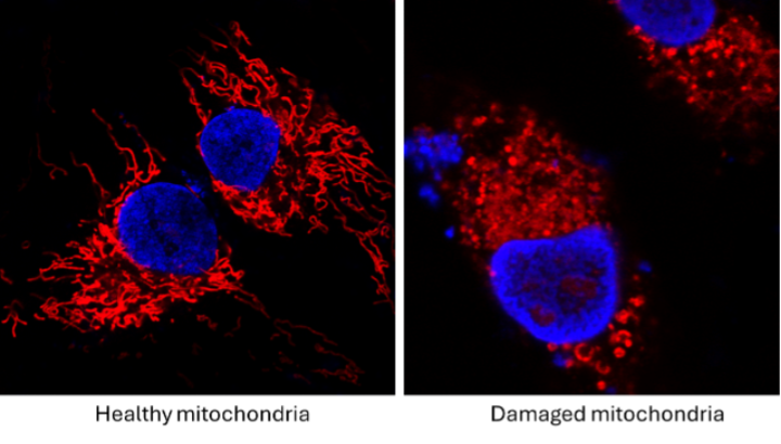 18. Mitochondria