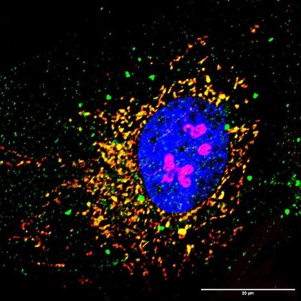 2. Lighting Up Mitochondrial Stress - SNX9 Dynamics in Parkinsons disease