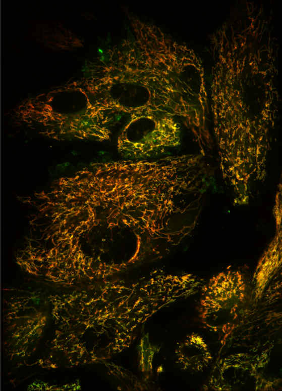 3. Glow and behold - Mitochondria on the move