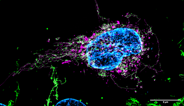 6. Bumpy mitochondrial track - a roadway to disease