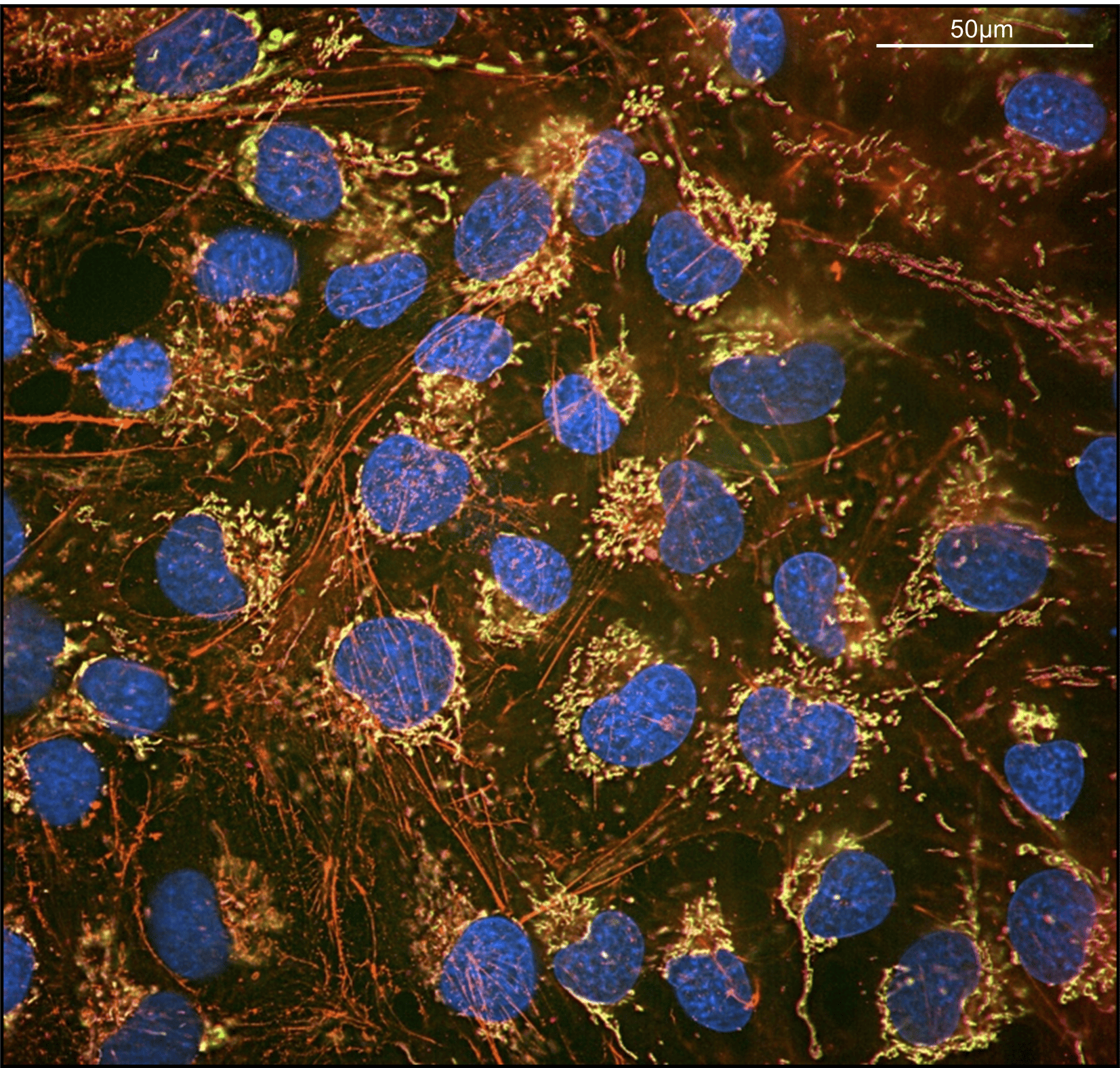 Human cardiomyocytes1