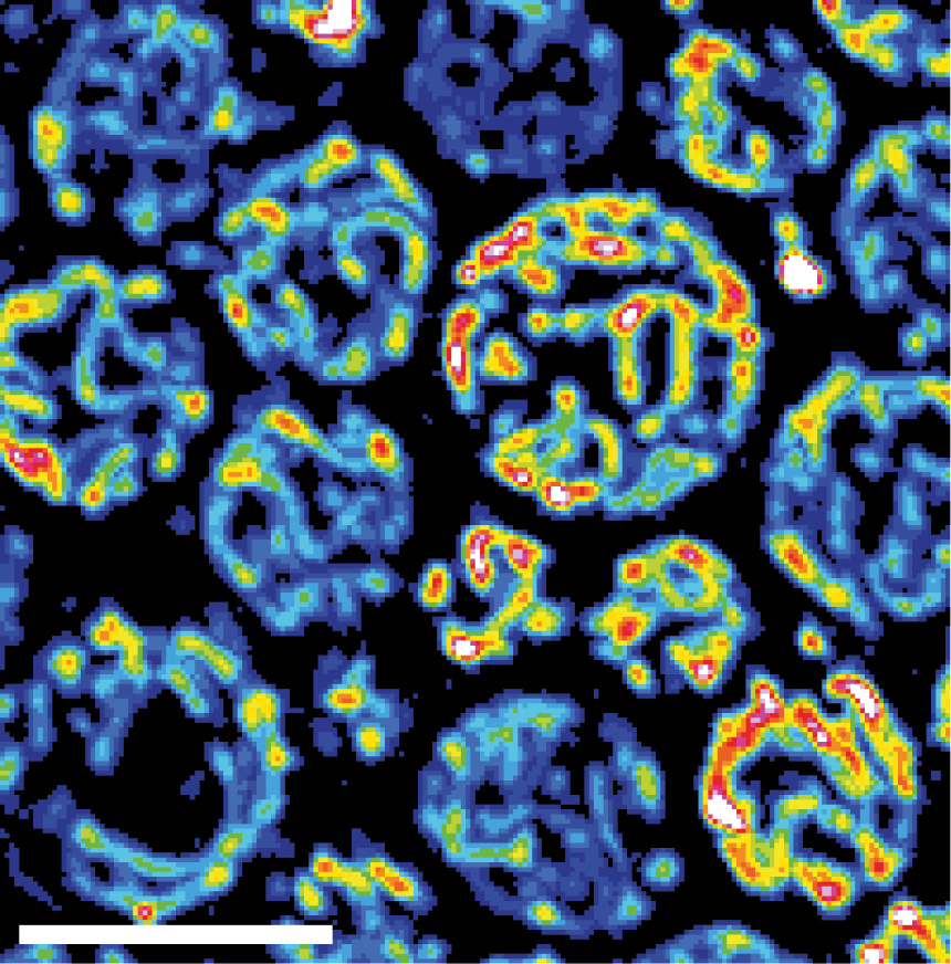 The mitochondrial network is shown in yeast cells. The reddish coloring indicates the fitness of the mitochondria. N. Photograph: Vögtle/ZMBH