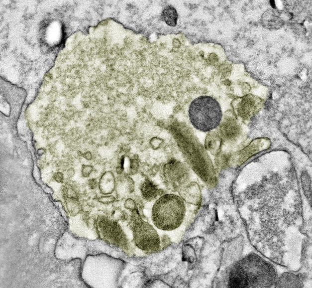 2. Shannon Swart - Mitochondria on the move