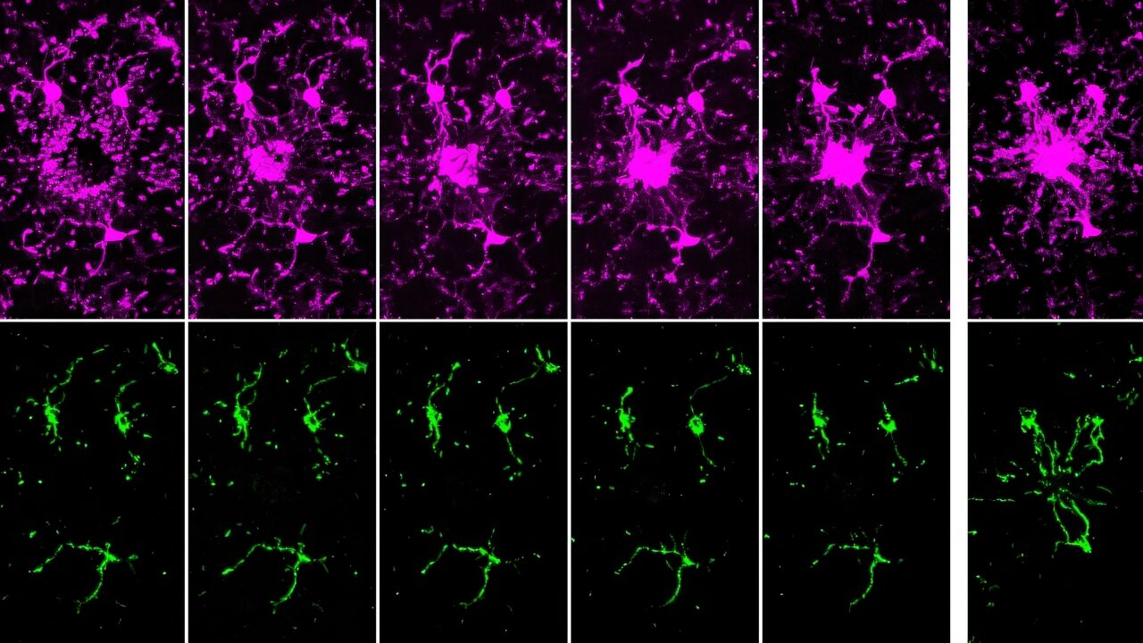 Sugar first, mitochondria later: how brain immune cells respond to injury