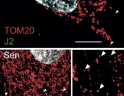 A new driver of inflammation in aging: Mitochondrial RNA leakage