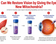 First Mitochondrial Transplantation into the Human Eye: A New Frontier for Organelle Therapy