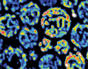 Mitochondria Detect Stress Earlier Than Previously Thought