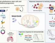 Exploiting Mitochondrial Metabolic Vulnerabilities in Glioblastoma: Therapeutic Potential of Mubritinib